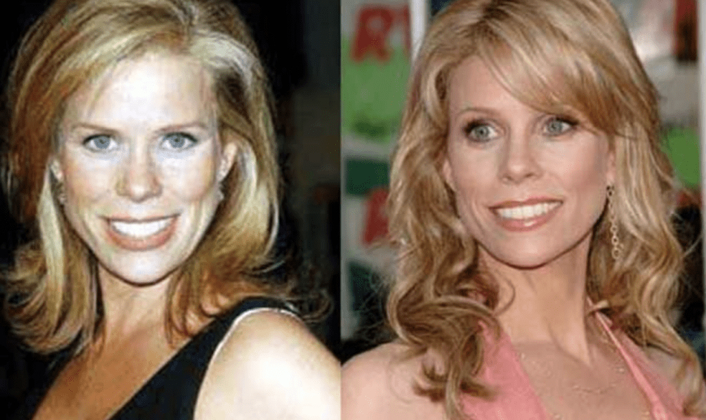 experts opinions on rumour of cheryl hines plastic surgery